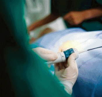 Image: Siemens’ Acuson AcuNav V ultrasound catheter has been developed for real-time volumetric intracardiac echocardiography (Photo courtesy of Siemens Healthcare). Image: Siemens’ Acuson AcuNav V ultrasound catheter has been developed for real-time volumetric intracardiac echocardiography (Photo courtesy of Siemens Healthcare).